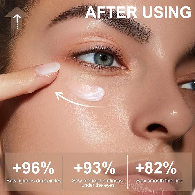 Caffeine Eye Cream for Dark Circles Under Eye Serum Eye Treatment for Wrinkles Fine Lines, Retinol Eye Cream for Puffiness and Bags Under Eye Serum with 360° Massage Roller-Ball