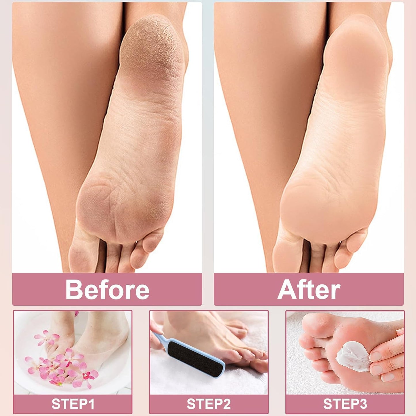 36 Pieces Flat Shaped Foot File Foot Callus Remover with Double Sided Feet Rasp Professional Pedicure Foot File for Grit Exfoliates Removes Dead Skin,3 Colors