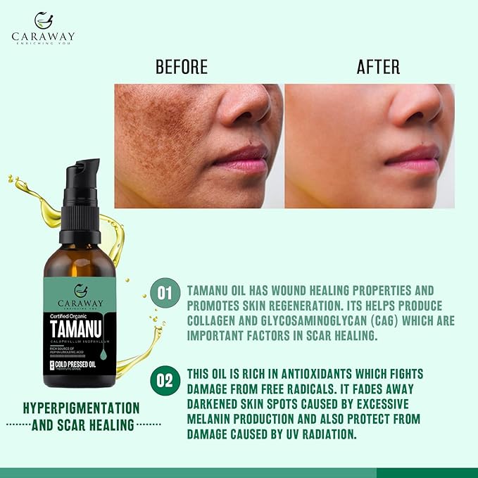 CARAWAY Tamanu Oil Organic for Skin - Cold Pressed - Natural Moisturizer for Dry Skin, Face and Hair - Helps Treat Hyperpigmentation, Acne scars, Eczema, Psoriasis- 1.7 Fl oz - 50 ml