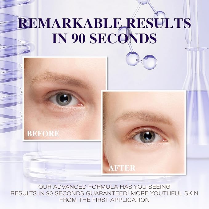 Under Eye Bags and Wrinkles - 2.0 Instant Face Lift Cream,Remove Dark Circles, Bags Under Eyes, Fine Lines, Wrinkles and Neck Lines,Firming Delicate Skin 1.01oz