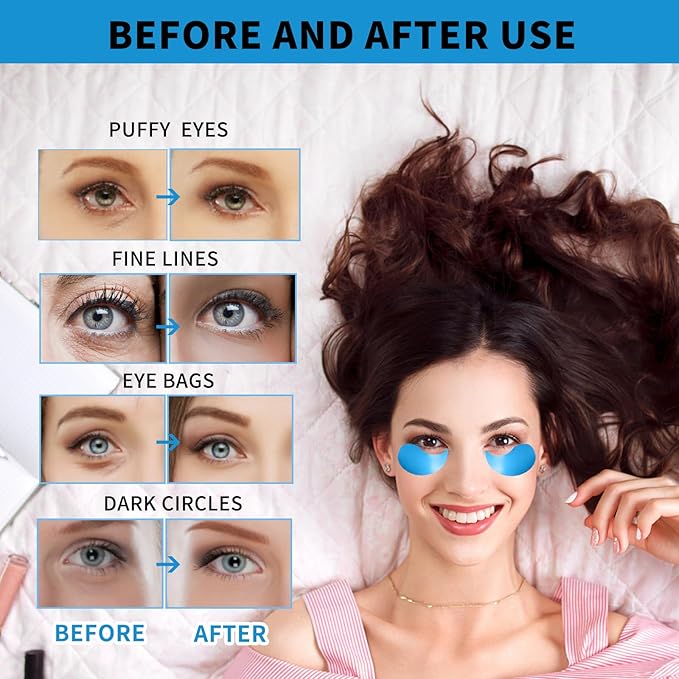 Under Eye Masks for Dark Circles and Puffiness 70PCS, Under Eye Patches for Puffy Eyes Treatment, Under Eye Gel Pads w/Collagen, Retinol, Hyaluronic Acid for Eye Bags Treatment, Gel Eye Mask Skincare