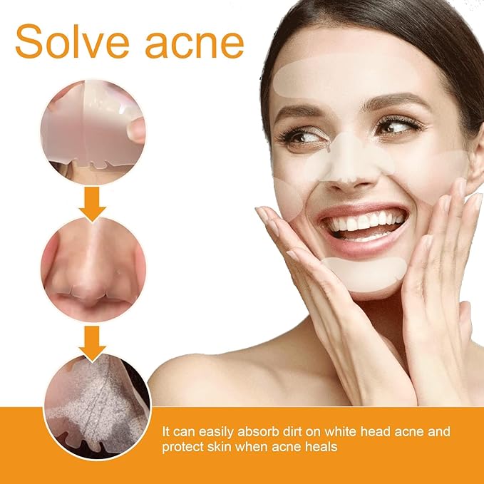 40Pcs Hydrocolloid Acne Patches Full-Face Coverage Kit for Pimples & Blemishes, Skin Care Solution for Clearing Spots