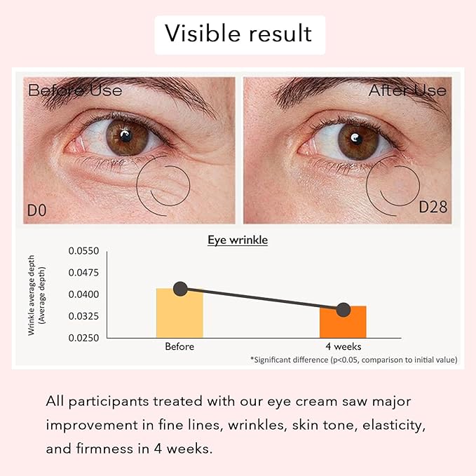 Revive Eye Serum, Anti-Aging Eye Cream for Dark Circles, Wrinkles & Puffiness, Visibly Smoothes Fine Lines, Daily Use, 30ml, 1 fl.oz