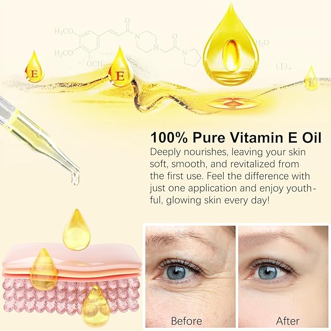 Vitamin E Oil 75,000 IU - Natural Moisturizing Oil for Skin, Face & Body - Organic Vitamin E Oil for Scars, Wrinkles & Stretch Marks - Deep Hydration 2 Fl Oz