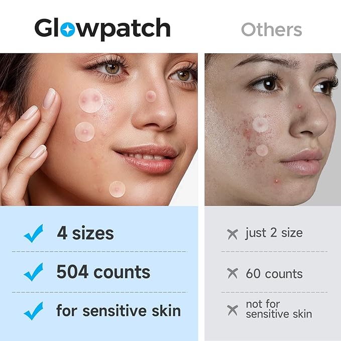 Pimple Patches for Face (504 Counts), Bulk Acne Patch, Zit Stickers 4 Sizes, Hydrocolloid Spot Stickers, Clear Acne Dots for Covering Zits, Blemishes and Breakouts