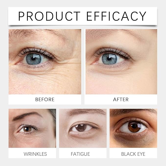 Under Eye Cream Dark Circles, Under Eye Skin Treatment Cream Reduces Puffiness, Fine Lines, Wrinkles and Eye Bags, Day & Night Brightening, Moisturizing & Firming Eye Serum with Vitamin C & Retinol