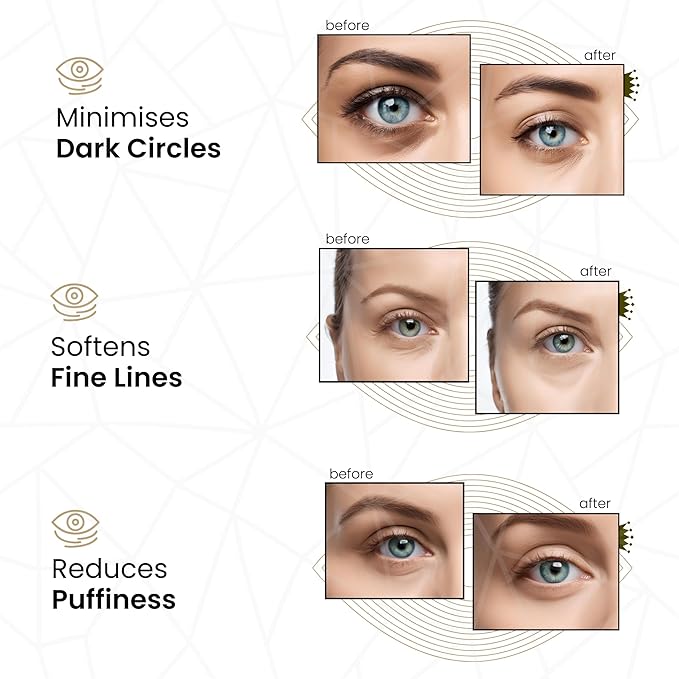 24k Gold Under Eye Collagen Patches, Reduce Puffy Eyes & Dark Circles, Illuminate Tired Eye Masks - Firms, Brightens, Energises (Packets - 10 Pair)