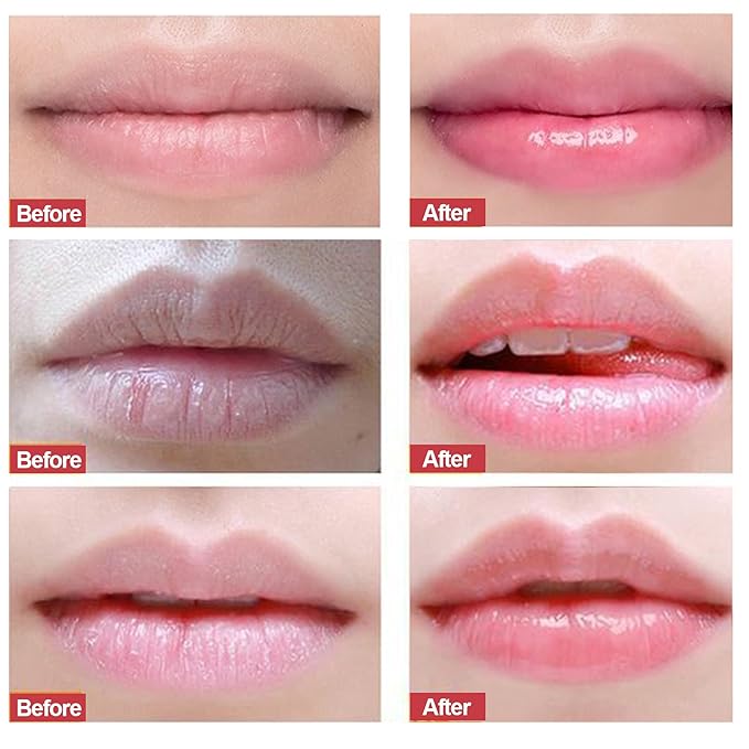 Lip Scrub, Exfoliator Moisturizer Lip Sugar Scrub Moisturizing Collagen Lip Balm Mask Night Sleep Lip Mask Effectively Moisturizes And Repairs Dry Lips Lip Treatment - Strawberry
