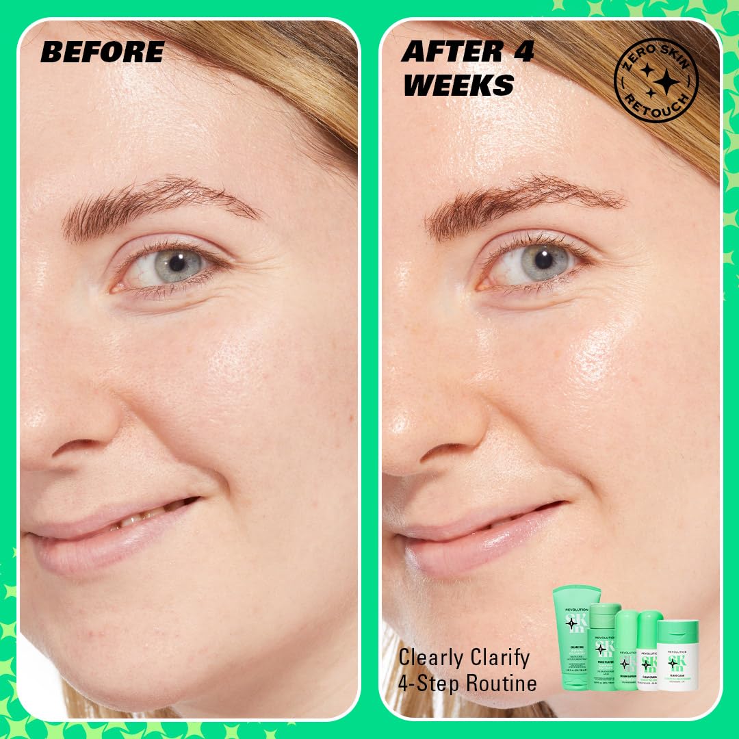 Revolution Skin, Clearly Clarify 4 Step Starter Kit, Skincare Set for Blemish-Prone Skin with Cleanser, Toner, Serum & Moisturizer, Vegan & Cruelty-Free, 4 Mini Products