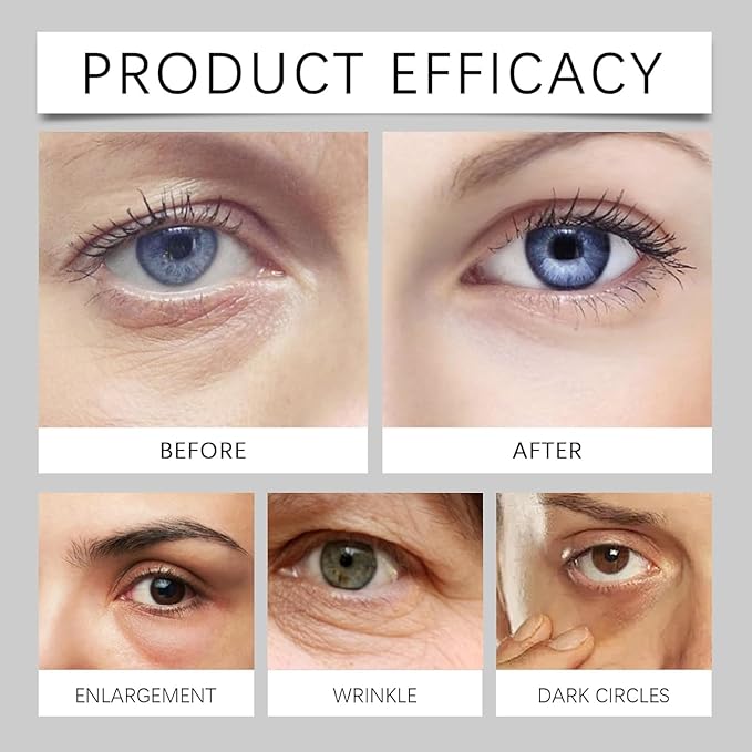 Lumibalm Stick For Under Eye Bags, Lumistick For Eye Bags, Suitable for eliminating puffiness, reducing fine lines, Deeply Moisturizes (2PCS)