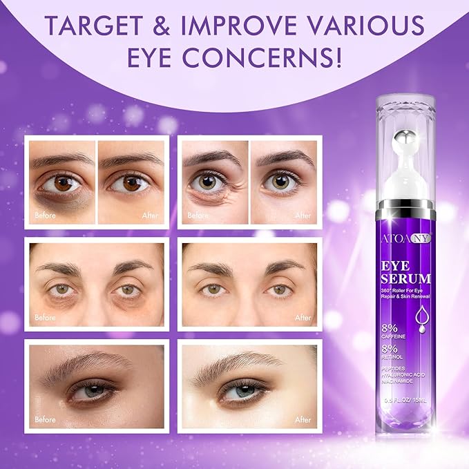 2 Packs Eye Serum for Dark Circles and Puffiness with 8% Caffeine 8% Retinol Hyaluronic Acid Niacinamide, Under Eye Cream Anti Aging for Puffiness and Bags with 360° Eye Roller Ball for Women & Men