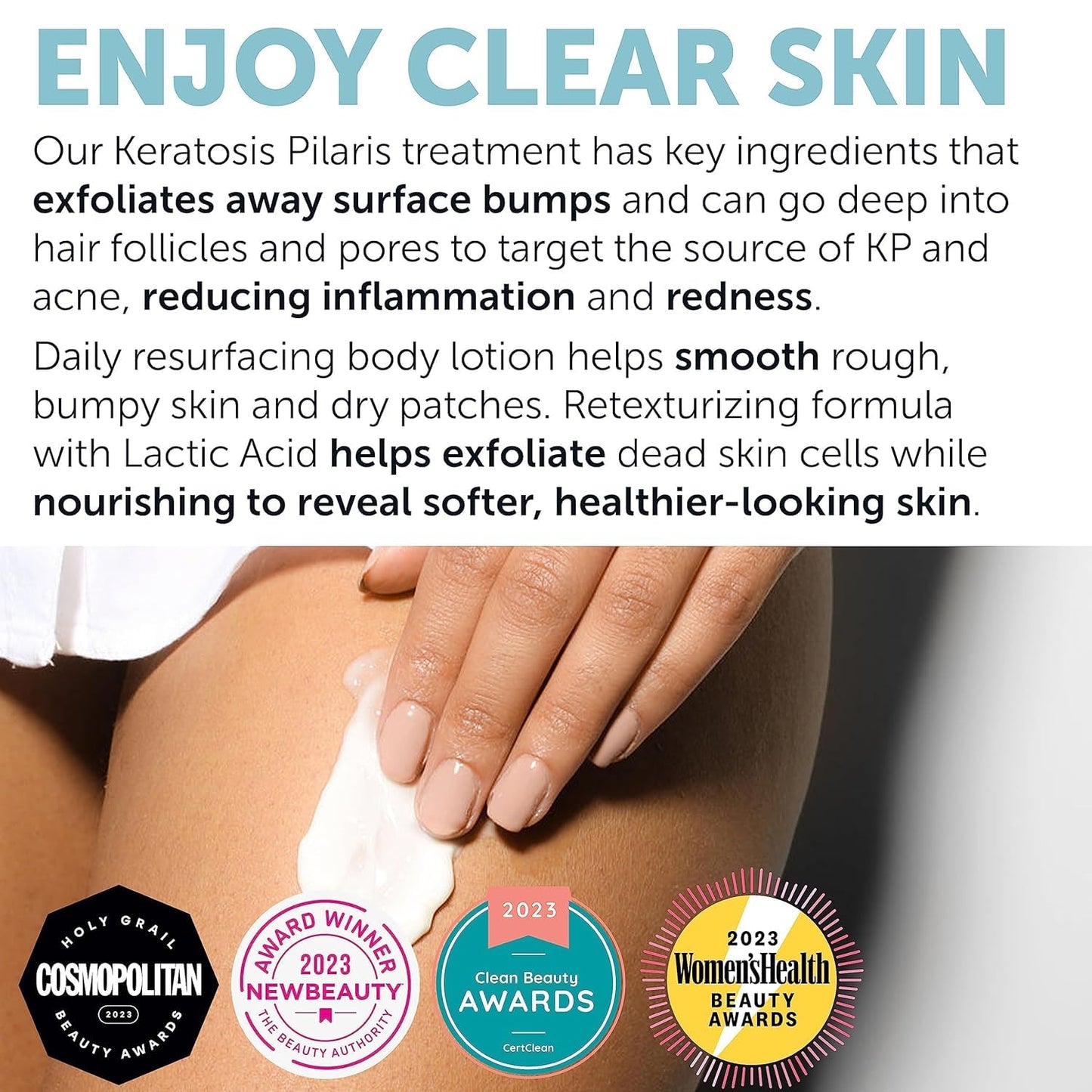 Keratosis Pilaris Treatment | Keratosis Pilaris Lotion | KP Lotion | Gentle Exfoliation For Strawberry Legs, KP & Ingrown Hairs | Smooth & Hydrating Body Lotion For Redness, Dry, Rough And Flaky Skin