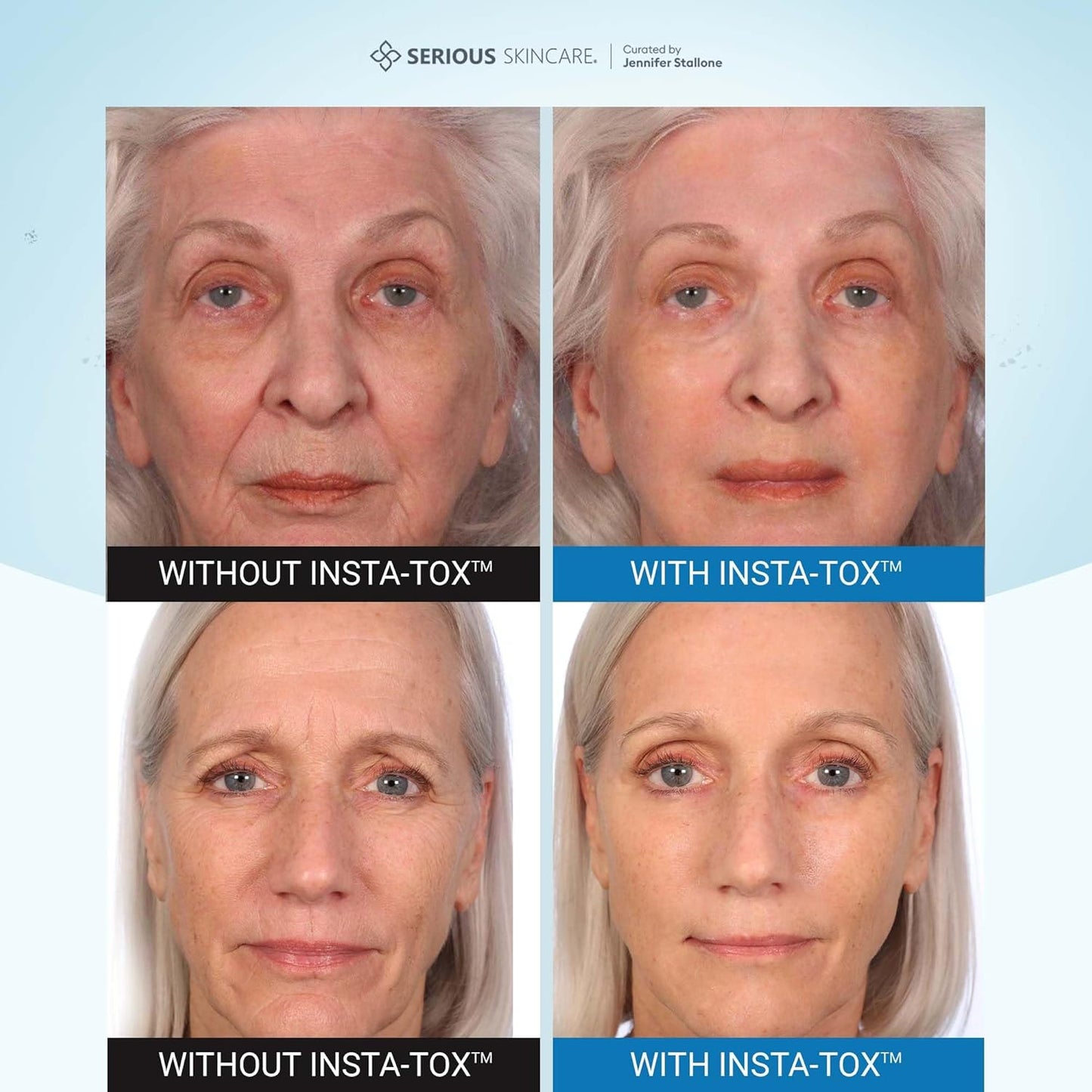 Serious Skincare INSTA-TOX Instant Wrinkle Filler for Face Serum, to Smooth + Blur Fine Lines, Deep Wrinkles, Lip Lines, Crow’s Feet & Pores, Temporary Face Tightener, .75 oz