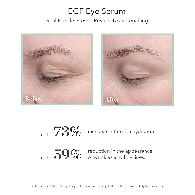 BIOEFFECT EGF Serum Value Skin Care Set, Gift Kit for Women & Men of Mini Facial Essence, Eye Treatment & Body Serum for Anti-Aging, Hydrating, Wrinkle-Fighting with Growth Factor and Hyaluronic Acid