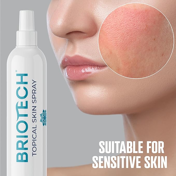 BRIOTECH Hypochlorous Acid Spray, Topical Skin Face & Body Mist, Support Irritations, Soothe Redness, Dry Skin & Scalp, Athletic Itch, Packaging May Vary
