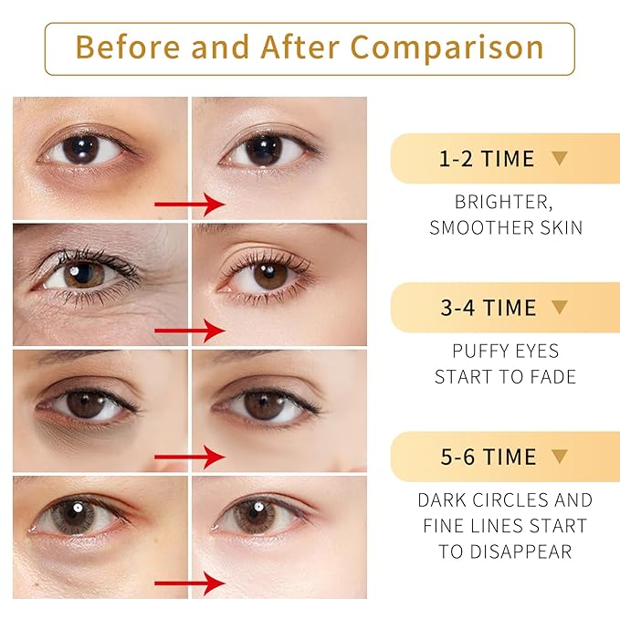 TUNBOT Under Eye Patches-24k Gold Eye Mask Pads - 60 Pieces, Collagen Hyaluronic Acid Eye Mask, Anti-Aging, Reduce Dark Circles, Puffiness and Wrinkles, For Men and Women