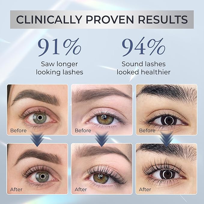 Abera Misan Eyelash Growth Serum – Natural Lash Booster with Red Ginseng, Biotin & Omega 3-6-9 – Fuller, Longer, Thicker Lashes – Safe for Sensitive Eyes (1 Box)