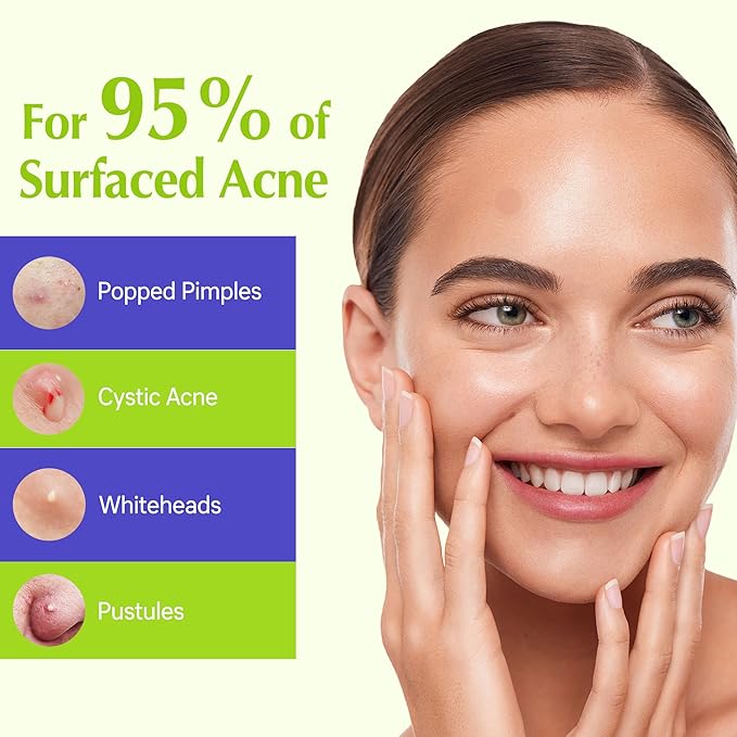 Pimple Patches For Face, Invisible Hydrocolloid Acne Patches Acne Treatment,Covering Zits & Blemishes in Skin and Face, Zit Patches with Salicylic Acid, FSA HSA Store Eligible Items 144 Count