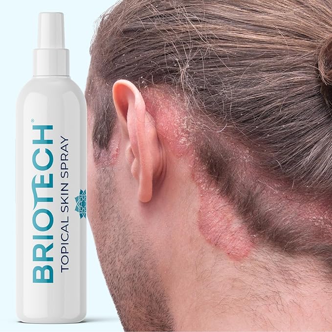 BRIOTECH Topical Skin Spray, Hypochlorous Acid Spray for Body & Face, HOCl Facial Mist, Support Against Irritation, Redness, Packaging May Vary, 4 oz ea, 2 ct