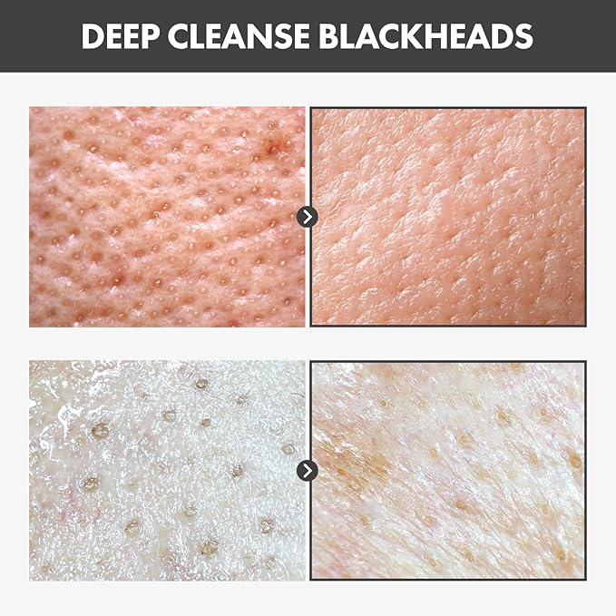 Blackhead Peel Off Pack, Charcoal Face Mask Peel Off for Blackheads and Pores, Deep Pore Cleansing, Pore Extractor Exfoliating mask, Korean Skincare, 50g, 1.76 oz.