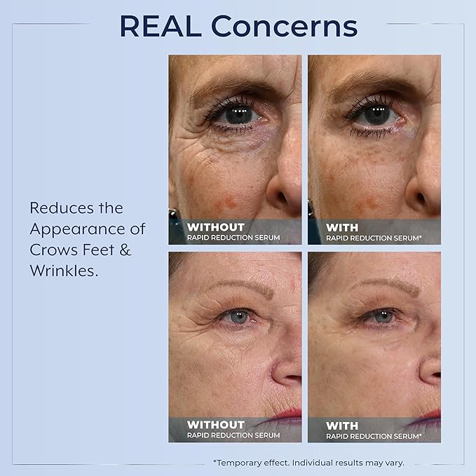 Plexaderm Rapid Reduction Eye Serum - Visibly Reduces Under-Eye Bags, Wrinkles, Dark Circles, Fine Lines & Crow's Feet Instantly, Anti Aging Wrinkle Remover for Face, 3 Full Size Tubes
