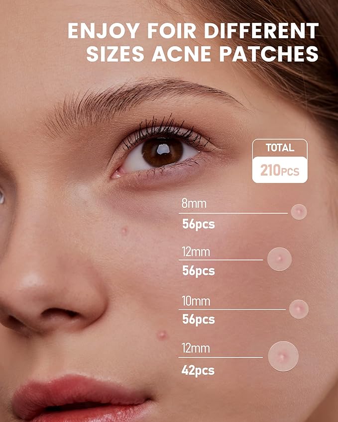 Pimple Patch 210 Counts 4 Sizes, Hydrocolliod Acne Patch for Face, Invisible Zit Patch with Tea Tree Oil & Calendula Oil, Blemish Patch, Vegan and Cruelty Free