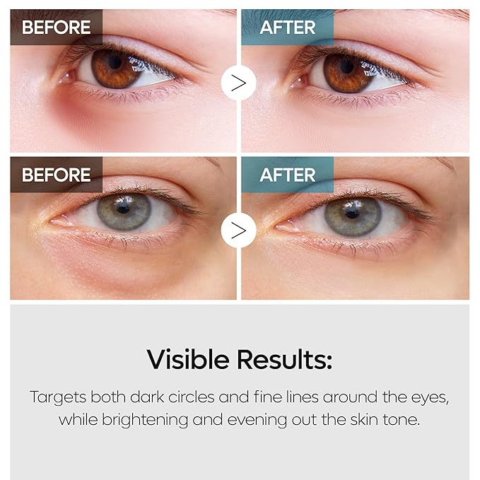 TX Tranexamic Acid Retinalsome Dual Eye Cream with Adenosine Niacinamide for Dark circle Repairing | Daily Anti-Aging Under Eye Care | 50ml - Korean Skin care