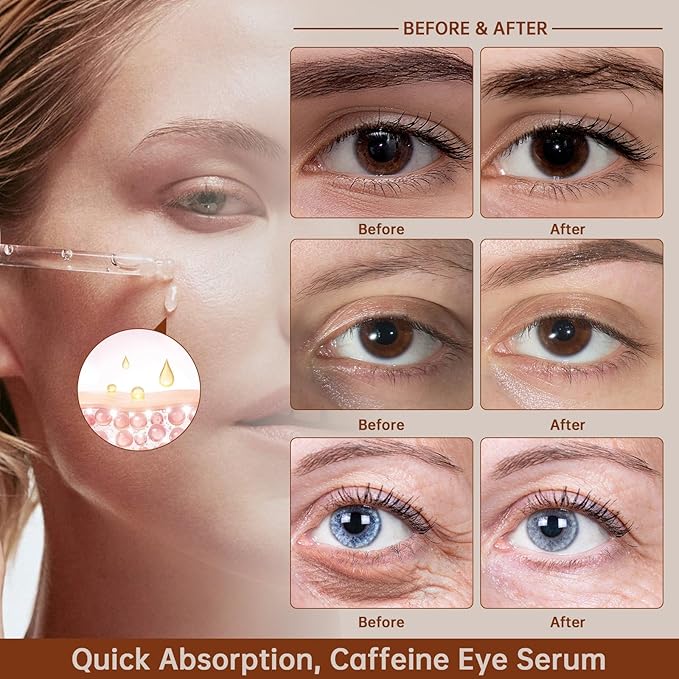 Caffeine Solution 5% + EGCG For Dark Circles & Puffiness, 2 PCS Anti Aging Caffeine Under Eye Serum For Eye Bags, Fine Lines, Moisturizing Caffeine Solution.