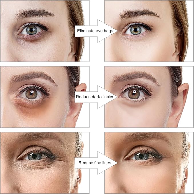 Under Eye Red Light Therapy Glasses with Dark Circle, Eye Bag and Wrinkle Elimination Massage
