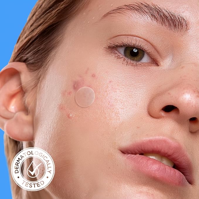 AVARELLE Pimple Patches for Face | Hydrocolloid Acne Patches for Covering Blemishes | FSA HSA Zit Patches with Tea Tree, Calendula, & Cica | HSA Store Eligible Items (10-14 mm, 200, Count)
