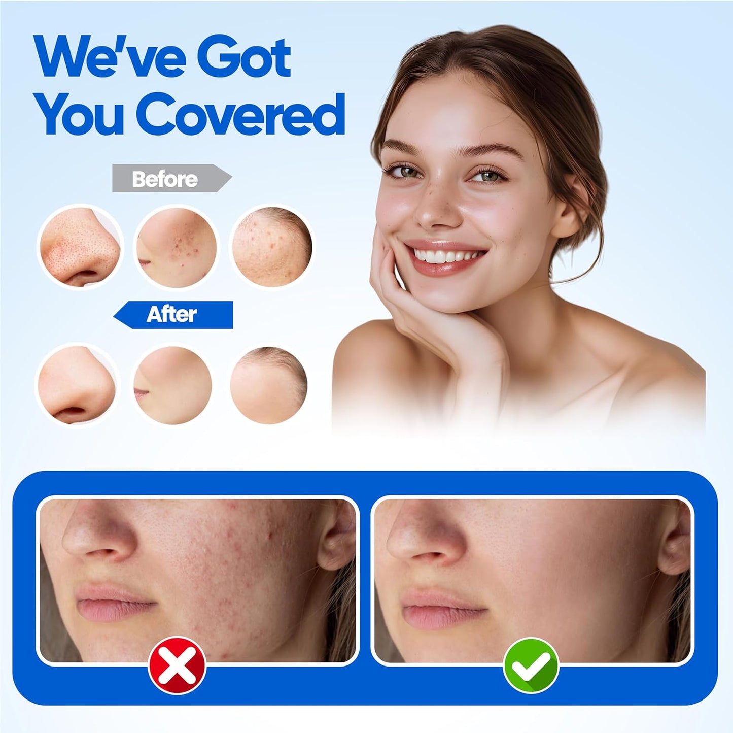 Blackhead Remover Extractor Pimple Popper Tools - Comedone Acne Zit Cleaner Kit for Nose Facial Pore Press Tool for Face Blemish Whitehead Popping Extractors, Stainless Steel 4 Pc Set by Krisp Beauty