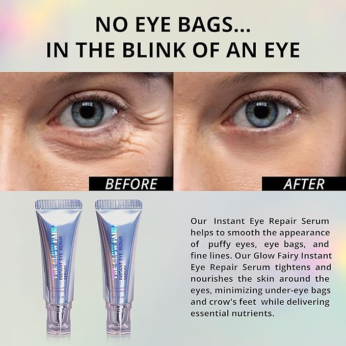 Eye Repair Serum (10g) – Under Eye Cream for Dark Circles, Puffiness, Fine Lines & Crow's Feet – Hydrate, Moisturize & Revitalize Skin with Caffeine Complex (2 Pack)