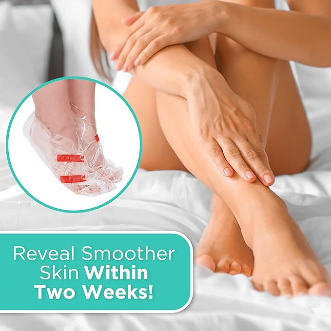 DERMORA Foot Peel Mask - 2 Pack of Large Size Skin Exfoliating Foot Masks for Dry, Cracked Feet, Callus, Dead Skin Remover - Feet Peeling Mask for baby soft feet, Vanilla Scent